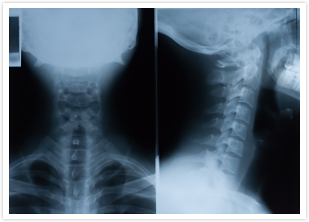neck and back pain